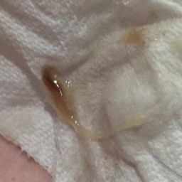 Brown stringy discharge w/pic - July 2023 Babies, Forums