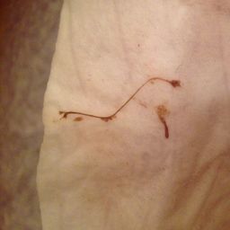 6 weeks pregnant and dark brown stringy type mucous discharge. No cramps.  Normal or not? - Glow Community