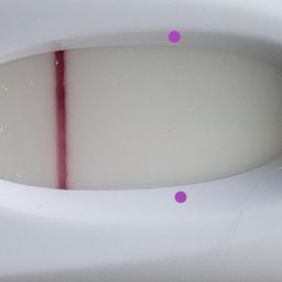 Is this a vvvfl? Showed up within 3 to 5min on a frer. 8dpo today