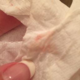 what does implantation bleeding look like on toilet paper
