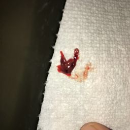 Blood Clot Or Miscarriage Glow Community Blood Clot Or Miscarriage Glow Community