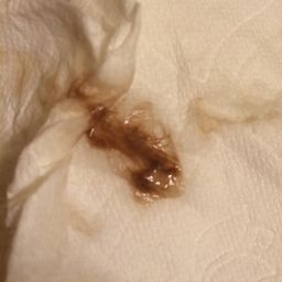 why do i have brown discharge but no period –