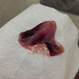 🔞WARNING TMI PICTURE🔞 HUGE uterine lining clot??? Worrisome? This came  out of me today and I'm kinda worried : r/birthcontrol