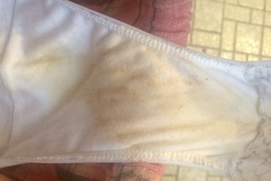 Yellow stain in underwear?? It's not pee, I'm pretty sure I would
