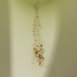 Brown Specks In Urine Early Pregnancy