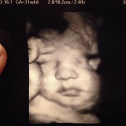 3d 4d Ultrasound 31 Weeks Glow Community