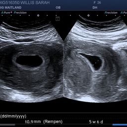 Tan colour (?) discharge? 8w4d and very scared, TMI pic warning - April  2021 Babies, Forums