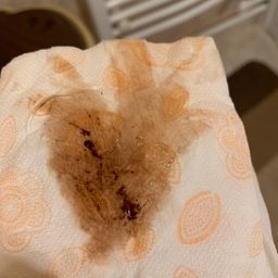 What's this brown discharge after my period? - Glow Community