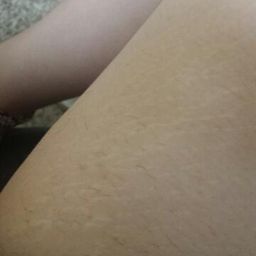 This is near my inner thigh it grows in like pubic hair thick and black is  this normal. I also get pretty long dark belly button hair as well... -  Glow Community
